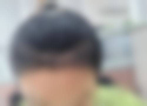 衡阳璐美仁医疗美容真人口碑评价怎么样？