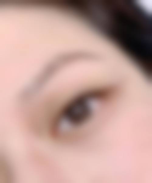 西安米兰柏羽医疗美容医院：注重术后成效