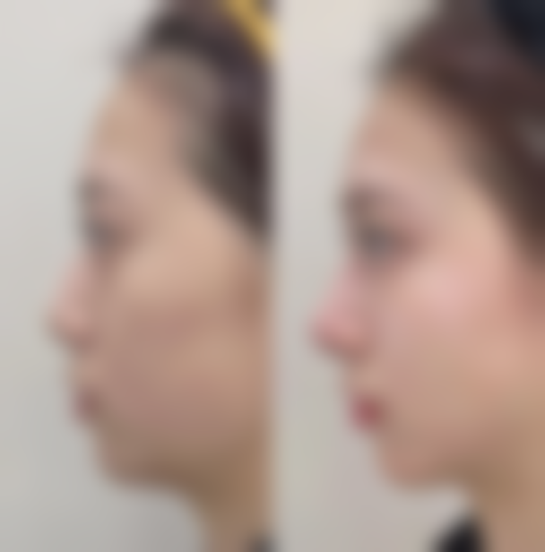 术前术后注意事项：保护治疗成效