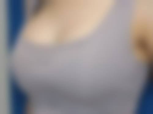 个性化方案：打造专属自然双眼皮