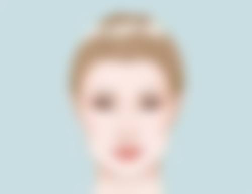 埋线法：轻度多层双眼皮的优选方案