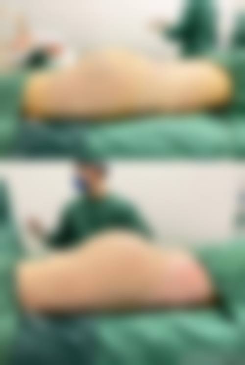 深圳天一医疗美容门诊部收费价格表/收费标准