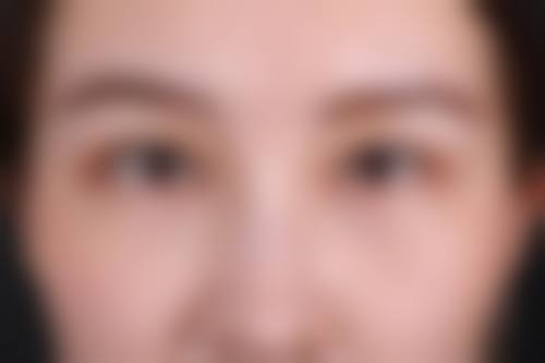 长春保丽盛轻颜整形医院真人口碑评价怎么样？