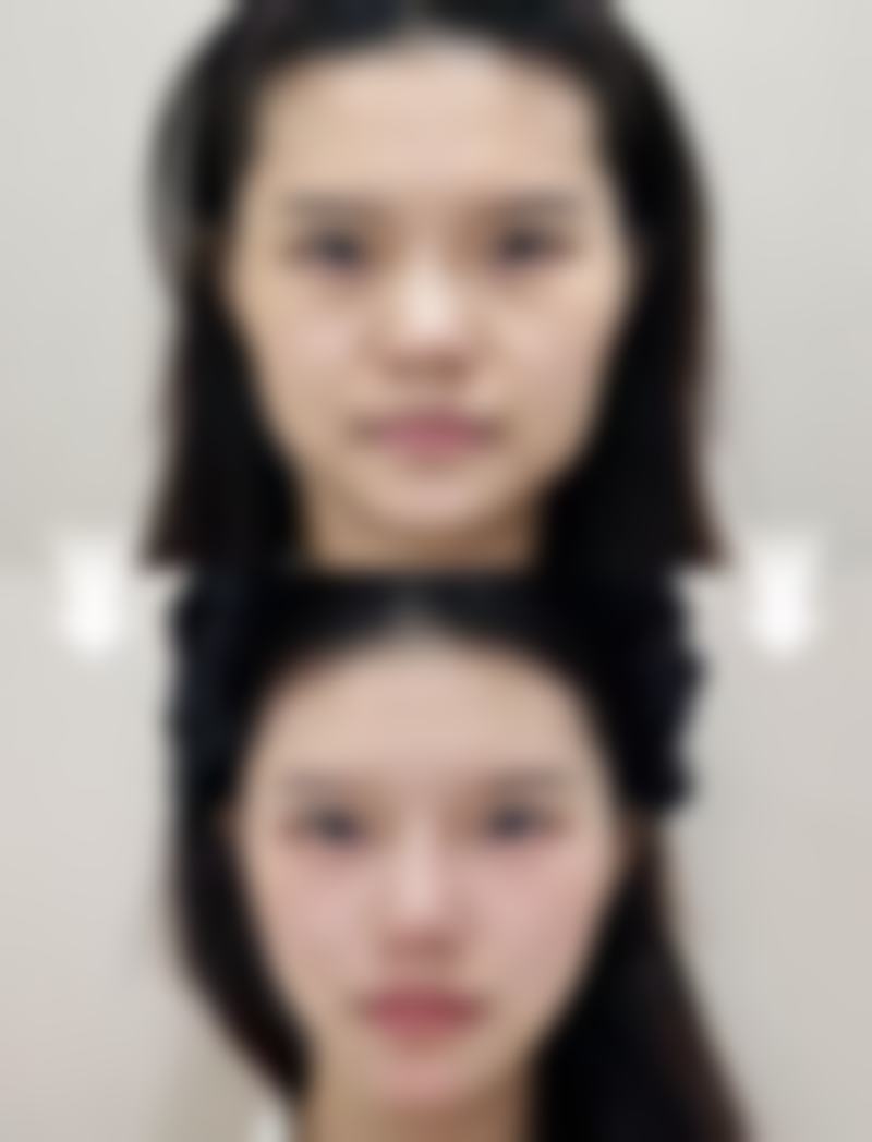 手术成效与收费价格