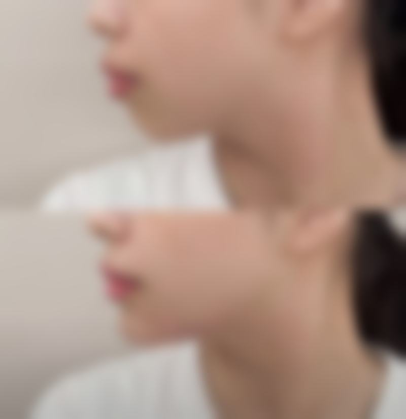 口碑评价与真人实例