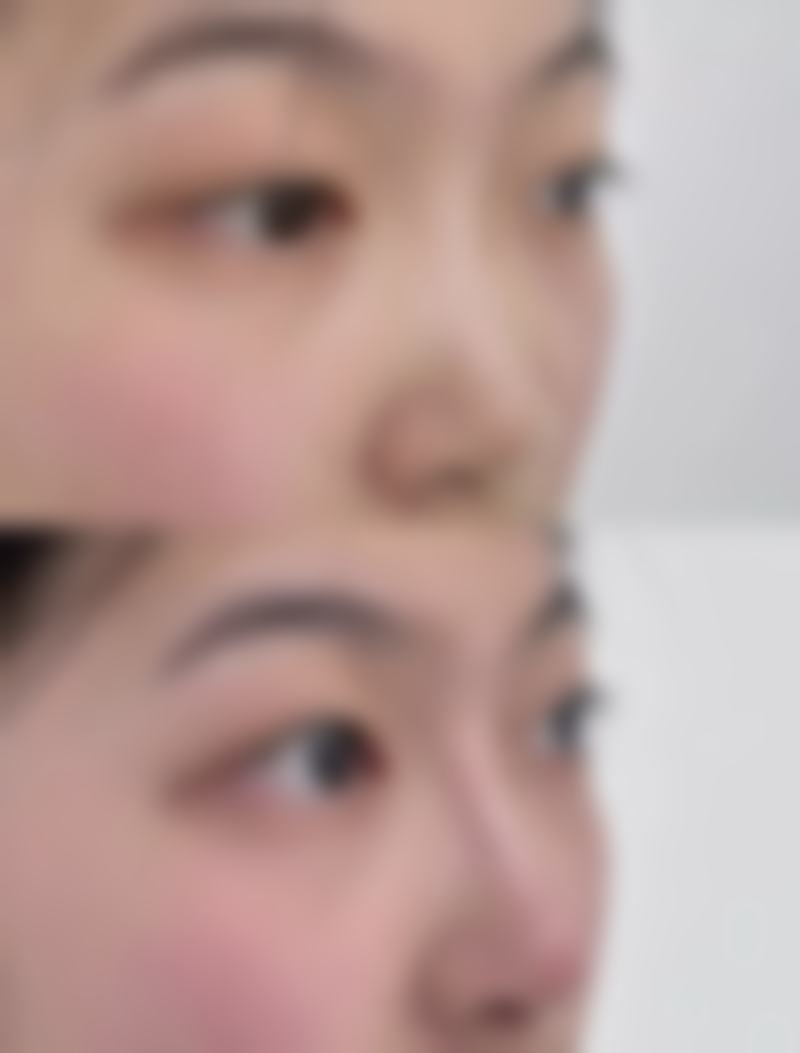 北京八大处：不用假体隆鼻的行业标杆！