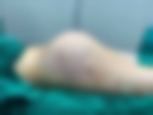 杭州阿薇医疗美容诊所真人口碑评价怎么样？