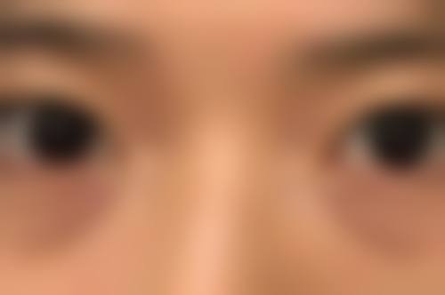 医院预约挂号方式