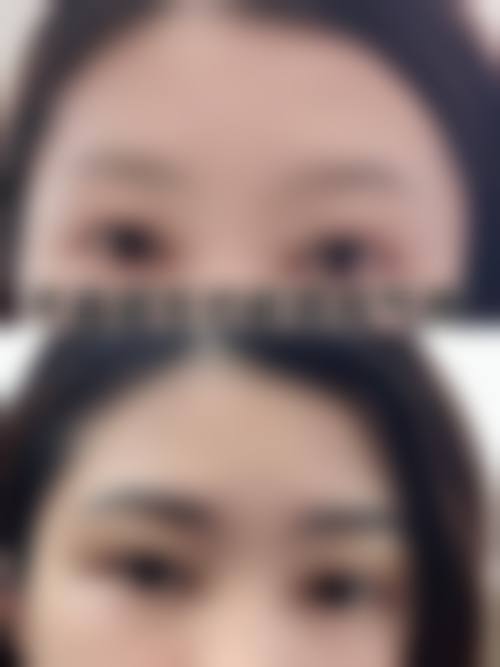 佛山大麦微针植发地址电话营业时间