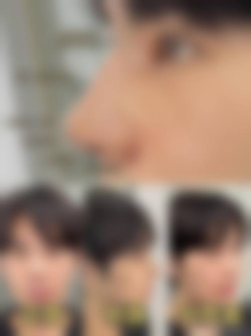 青岛菡汝整形医院收费价格表/收费标准