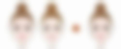 不同医院切缝疤痕手术修复时间有差异吗？