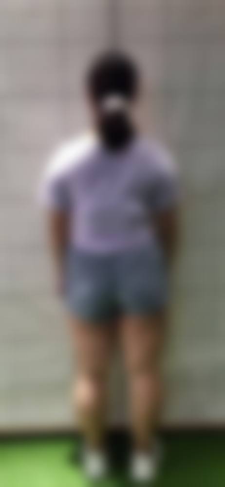 厦门脸博士医疗美容经验