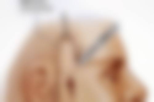 割双眼皮可以改善眼皮松弛吗？当然！XX 整形医院设备先进方案个性，术后效果获患者好评！ 