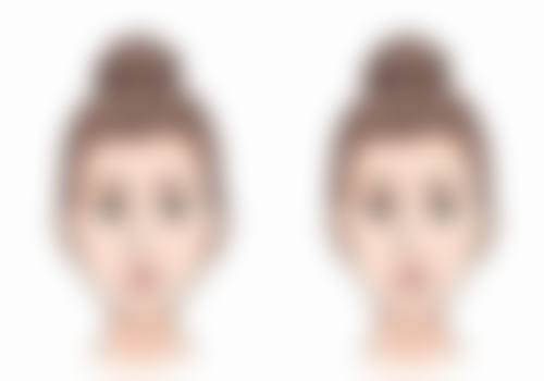 隆鼻取耳软骨之缺点全解析