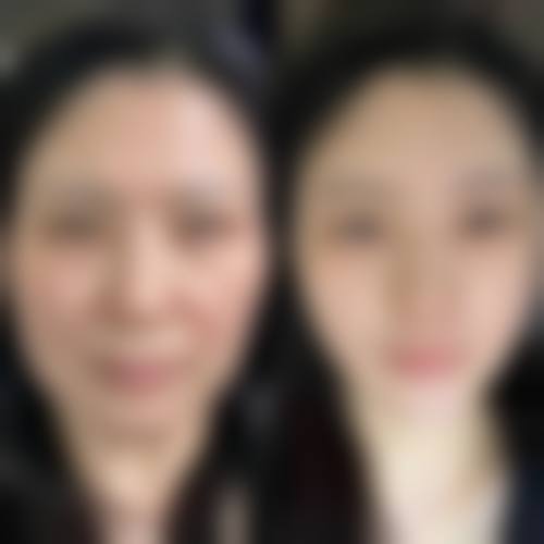 湖南时光医疗美容门诊部真人口碑评价怎么样？