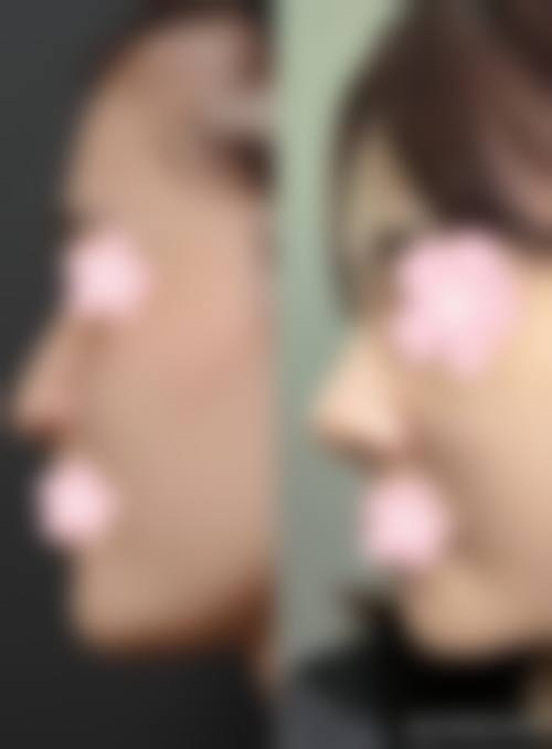 泸州华伊佰颜整形医院地址电话营业时间