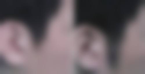 长沙惠丰植发（原长沙长海医院植发科）收费价格表/收费标准