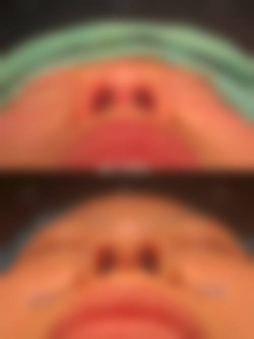 泸州华伊佰颜整形医院详细的预约挂号方式及流程