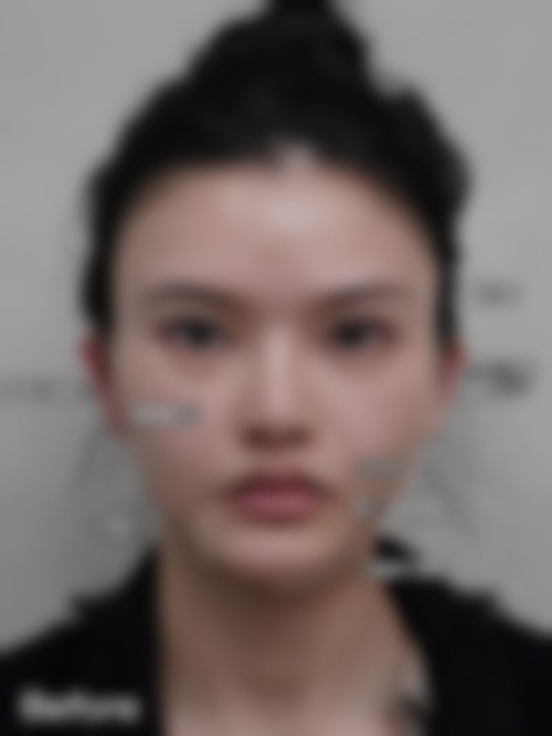 张沙沙医生手术成效