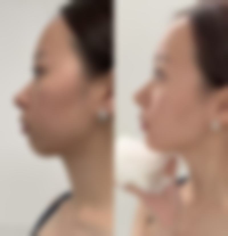 专精医生团队：为疤痕色素治疗保驾护航