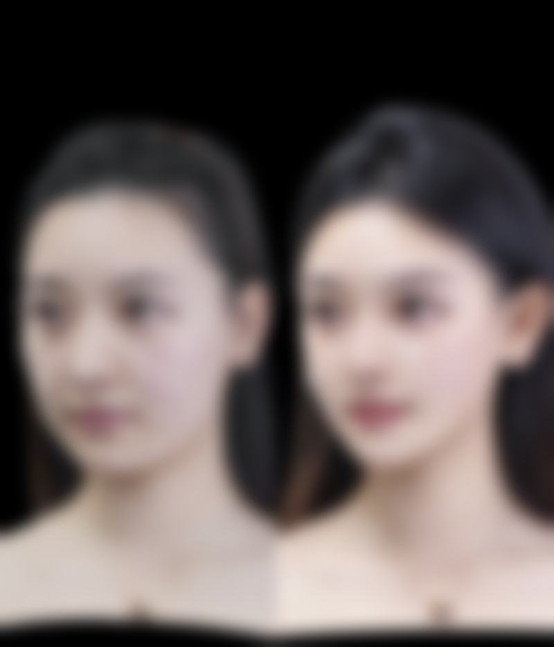 综合治疗方案：从根源改善疤痕色素问题