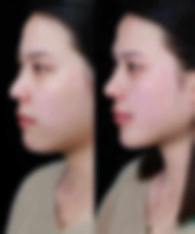 厦门思明荟美天成整形外科真人口碑评价怎么样？