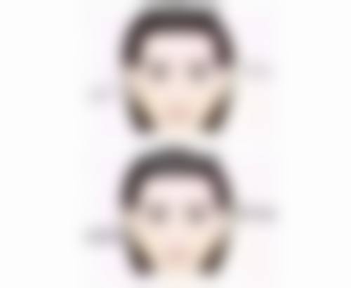 伤口清洁：保持卫生，防止感染是重点