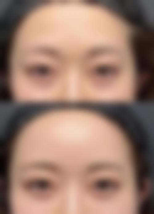 手术技术优势足