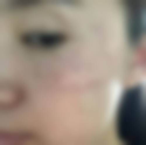 合肥丽星医学美容诊所特色项目及技术优势