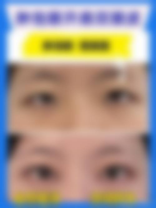 深圳米兰柏羽：高端医美品质保护