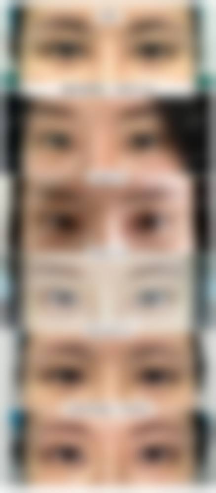 深圳曹孟君：吸脂填充专精之院