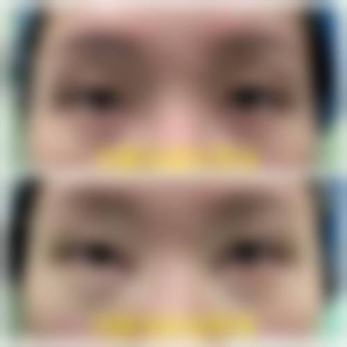 深圳鹏程：大型综合医美典范