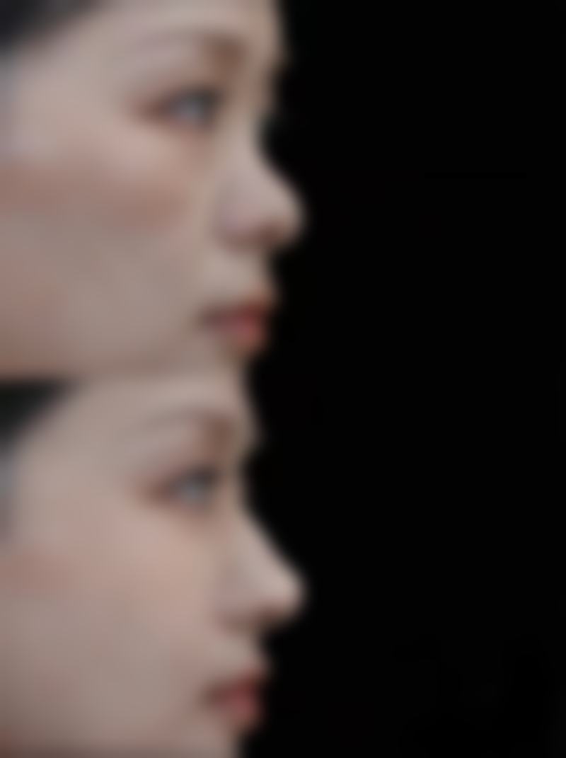 北京美莱瘦脸针收费情况分析