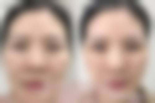 高人气轮廓整形前20强