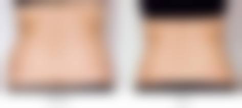 武汉新至美医疗美容详细的预约挂号方式及流程