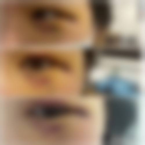 顾华艳医生擅长项目