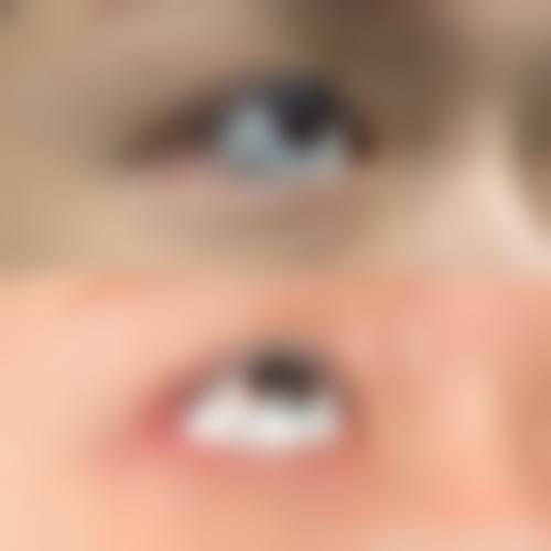 顾华艳医生技术优势