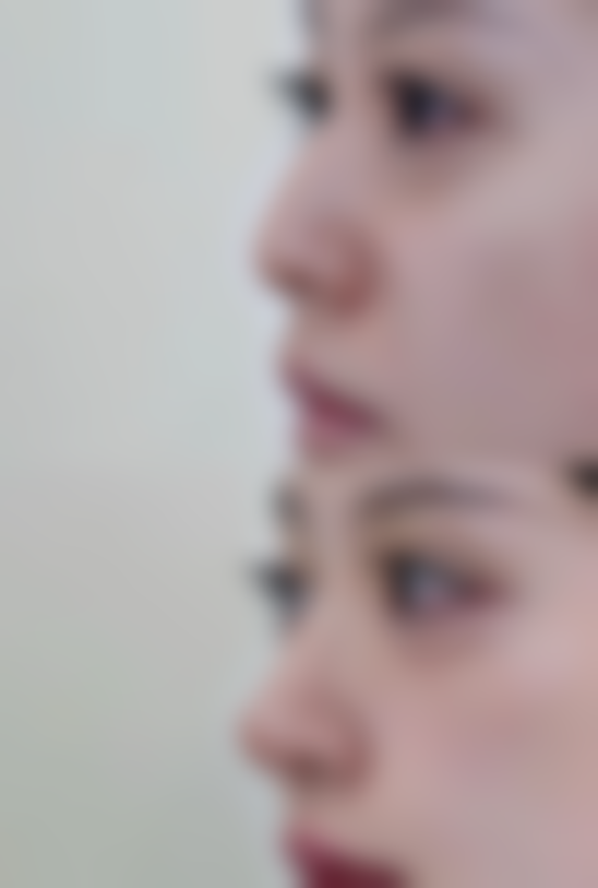 普宁伊丽莎白医疗美容诊所真人口碑评价怎么样？