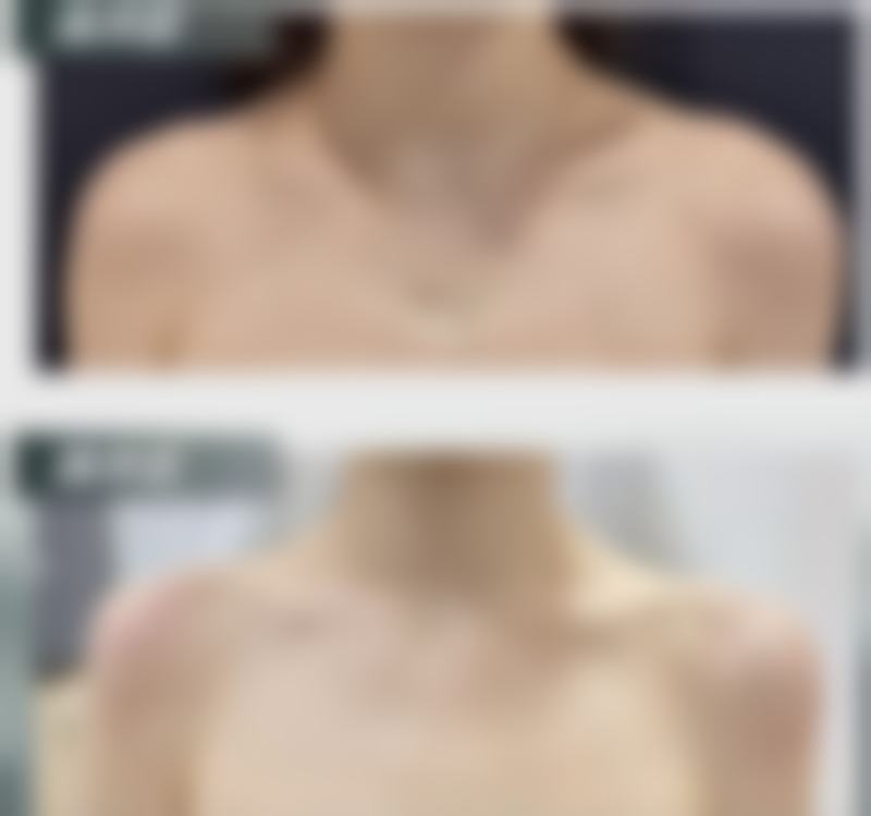 武汉新至美医疗美容收费价格表/收费标准