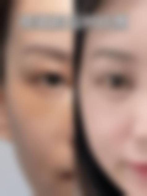 沈阳美医美塑医疗美容诊所真人口碑评价怎么样？