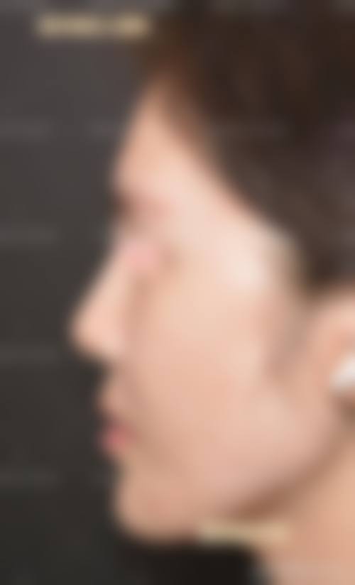 亳州市人民医院整形外科怎么样?