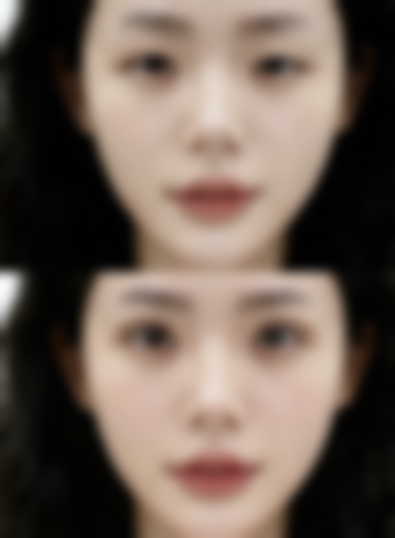 饮食调理助力消除顽固下眼袋