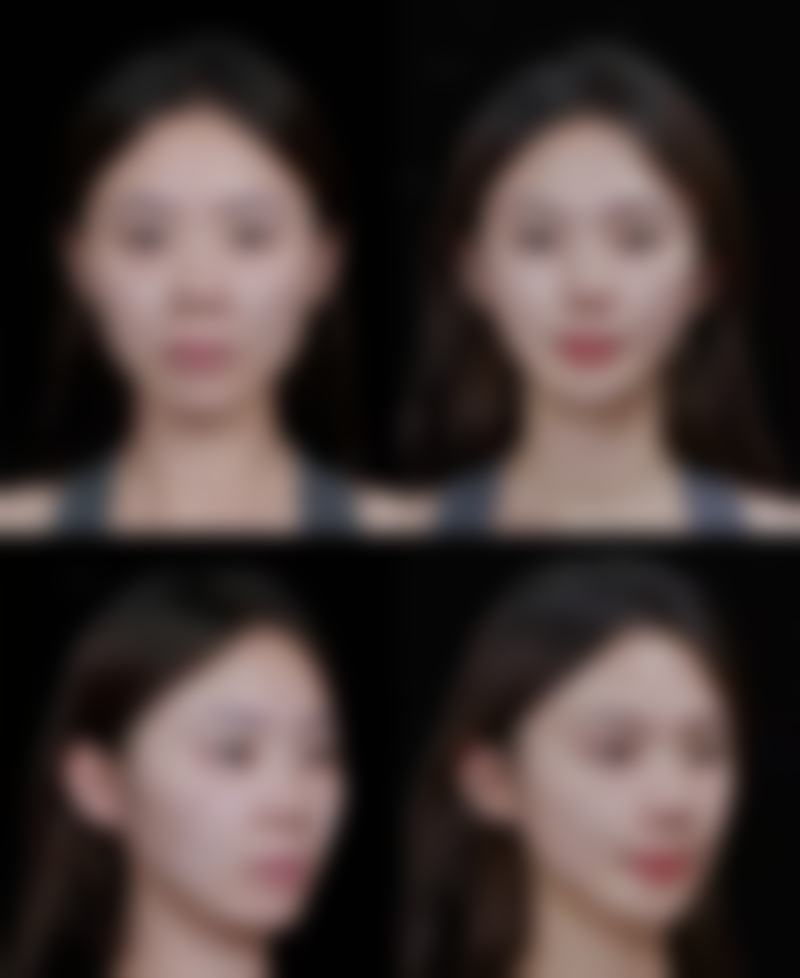 乌鲁木齐微拉美医疗美容门诊部价格表 / 收费标准一览