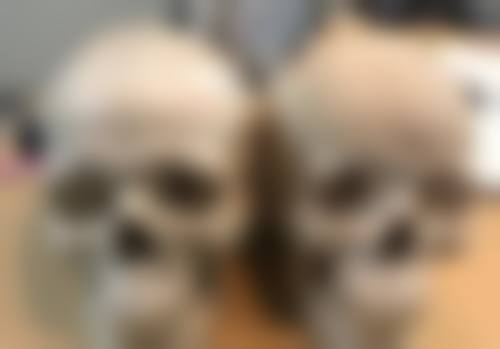 分类型解决眼袋,精细出击成效好