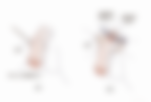 三点微创法：十天到十二天可修复化妆