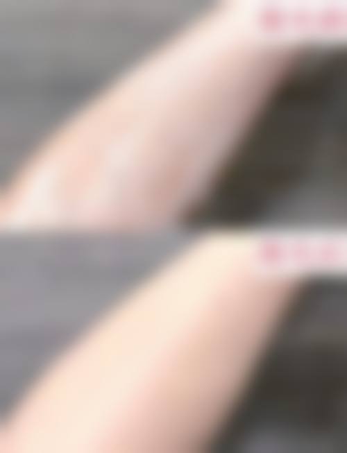 丽辰医疗美容诊所价格表 / 收费标准一览