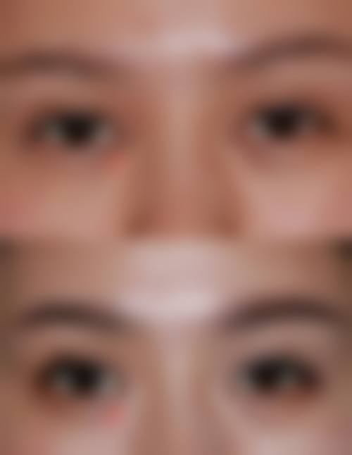 伊美芝皮肤科地址电话及来院路线