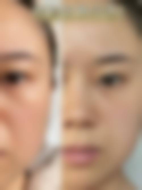 伊美芝皮肤科口碑如何？