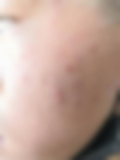 伊美芝皮肤科是国有的吗？