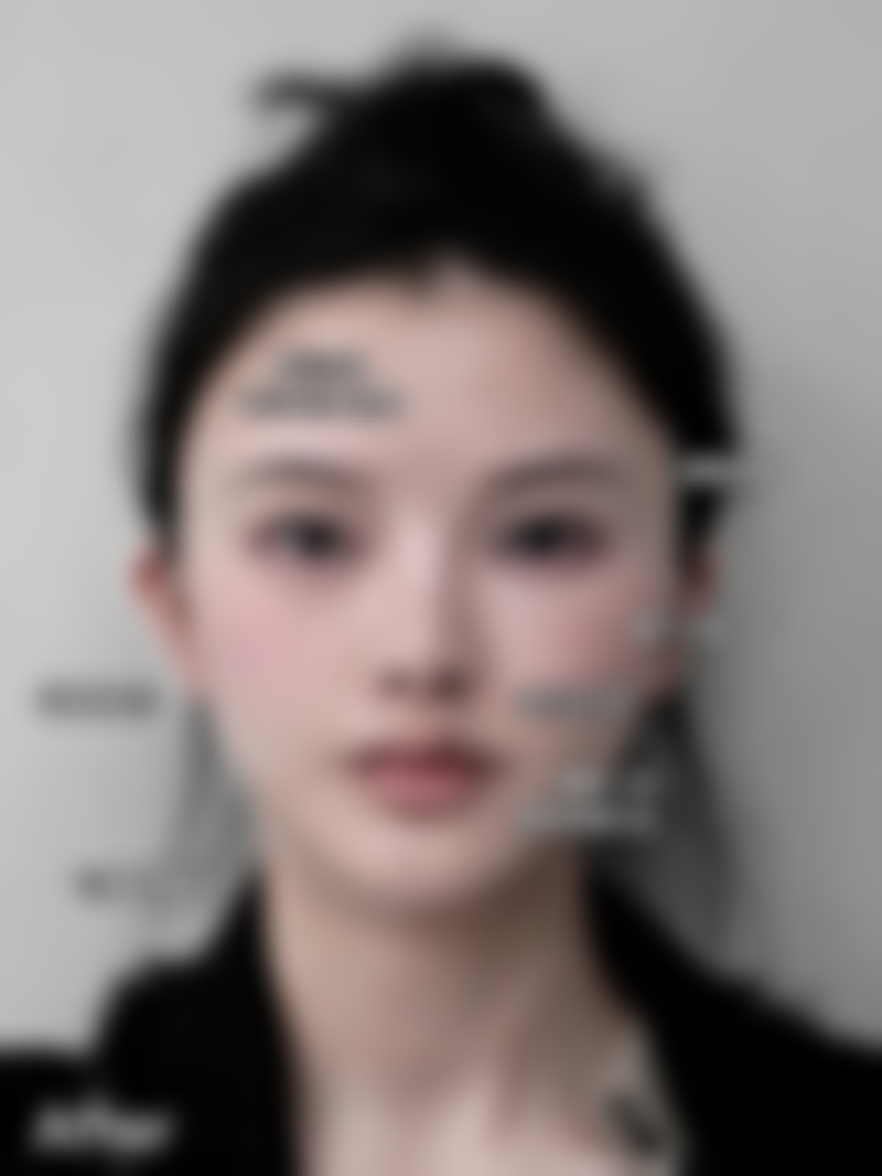 手术成效与口碑评价